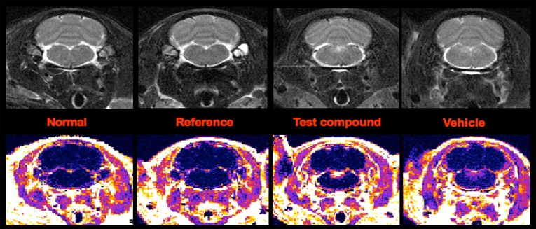 mri3